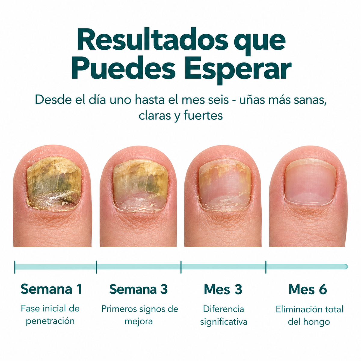 NAILVIA™ Cuidado Integral de las Uñas