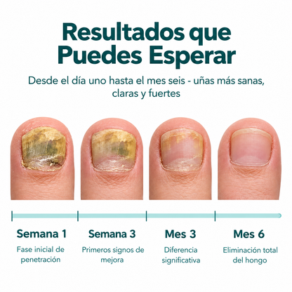 NAILVIA™ Cuidado Integral de las Uñas